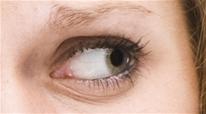 Dark Circles